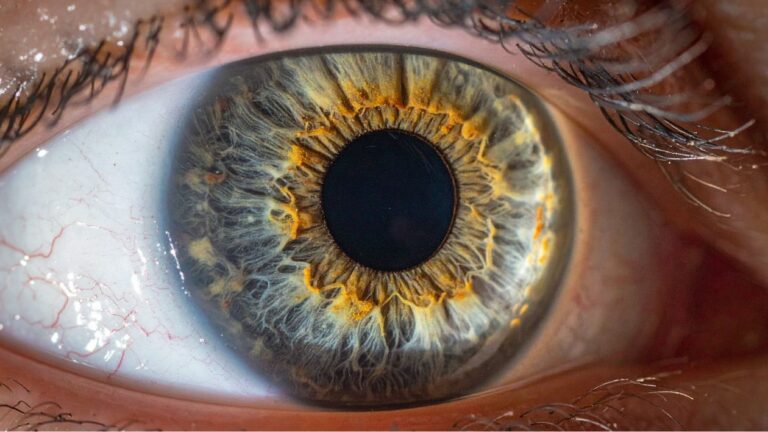 L’iridologie quand les yeux deviennent le miroir de la santé